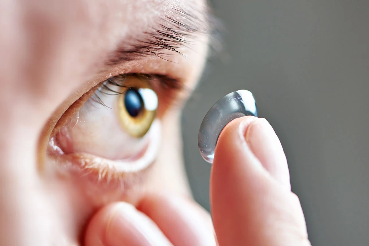 CONTACT LENSES